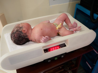 A newborn little girl has umbilical cord and blood being weighed to check her physical integrity and see other abnormalities in the delivery room.