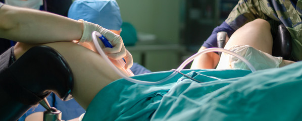 Surgeon doctor in operating room during gynecological biopsy