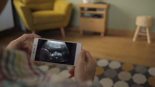 Pregnant Woman Looking at Ultrasound Scan on Smartphone Sitting on Sofa at Home. Third trimester pregnancy. Pregnant Woman Looking Ultrasound Video Her Baby on Mobile Phone. Gynecology Birth Childbirt