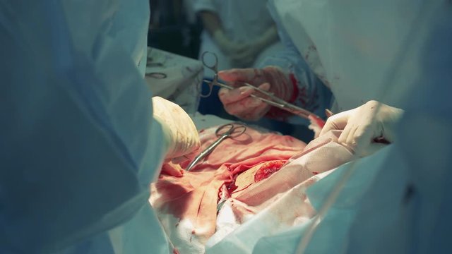 Surgery process with doctors treating a wound