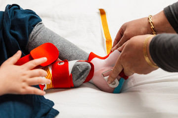 pies de un niño de 5 años con férulas ortopédicas para poder aprender ha andar, sujeción de los pies, prótesis pierna. la madre o fisioterapeuta se los está poniendo para los ejercicios terapéuticos. © Jordi Mora