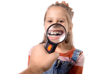 Little cute girl with an orthodontic appliance on a white background through a magnifier.