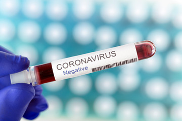 Negative result of coronavirus test in the laboratory.