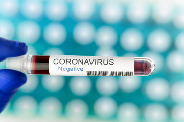 Negative result of coronavirus test in the laboratory.