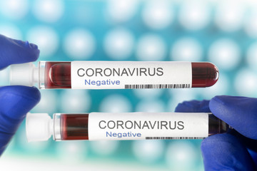 Negative result of two coronavirus tests as symbol of an end of pandemic.