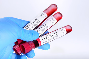 Obraz premium COVID-19 test and laboratory sample of blood isolated on white