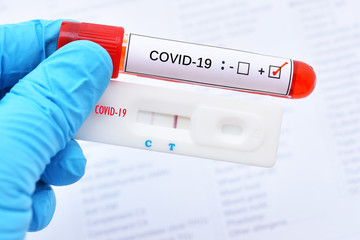 Fototapeta premium Positive test result by using rapid test device for COVID-19 virus