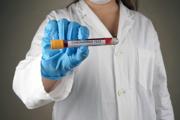 Coronavirus Blood Sample. Corona virus outbreak. Epidemic virus Respiratory Syndrome. Pandemic....