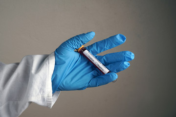 Coronavirus Blood Sample. Corona virus outbreak. Epidemic virus Respiratory Syndrome. Pandemic....
