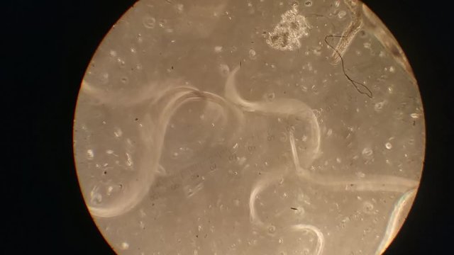 Close up of Micro organisms or microbes in microscop magnification. Macro, not 3d animation. Nano texture of Petri dish in microbiology lab. Abstract conceptual bio background. Microscopy zoom