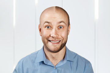 Fototapeta premium Portrait Man before and after hair loss, transplant. Split personality.