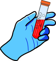 coronavirus blood test tube result positive on blue gloved hand