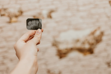 Panoramic x-ray jaw. A dentist holding an x-ray the patient's tooth and indicates the problem