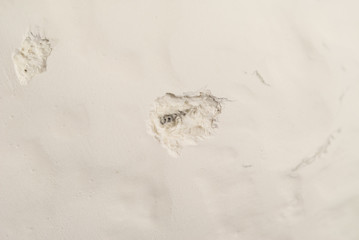 frattura, lacuna nel gesso