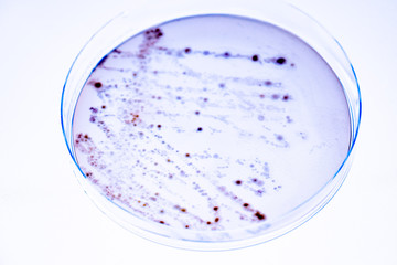 Growing Bacteria in Petri Dishes on agar gel Scientific experiment.