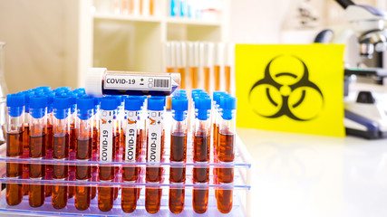 A doctor in the lab checking the test sample positive for coronavirus biological hazard sign