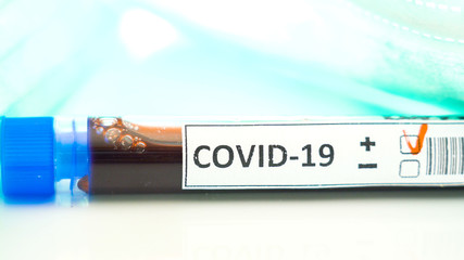 Blood samples inside the test tubes with positive mark for coronavirus