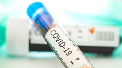 Fototapeta premium A test tube with blood sample positive for coronavirus