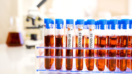 A lab doctor marking the test tube with positive for coronavirus 3