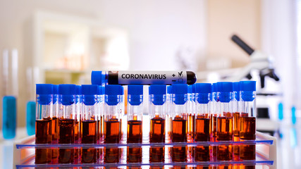 The test tube kit with positive mark for coronavirus