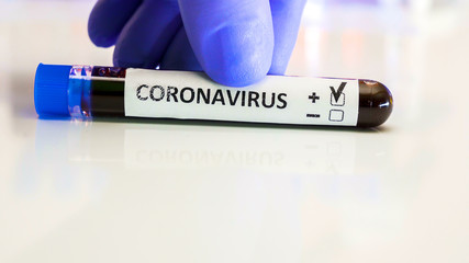 Obraz premium A test tube kit positive of COVID-19 coronavirus pandemic