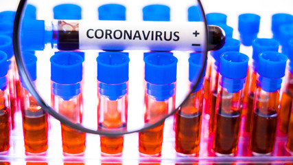 A magnifying glass checking the tube with COVID-19 coronavirus positive 2