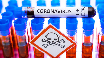 The hazard sign on the test tube rack with the sample for COVID-19 coronavirus