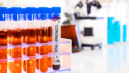 A tube filled with blood sample for COVID-19 coronavirus 2
