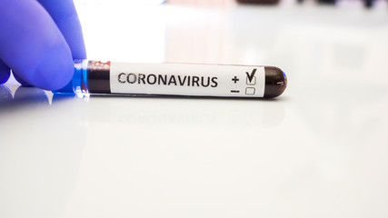 Obraz premium A small kit with blood inside for COVID-19 coronavirus