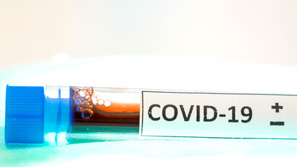Closer look of the Covid-19 sign on the sample kit for coronavirus