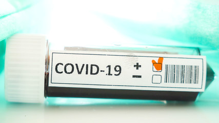 The closer look of the small sample kit for coronavirus