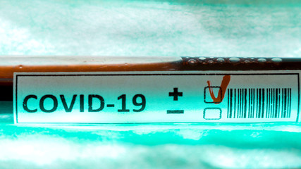 A closer look of the Covid-19 tube for coronavirus sampling 2