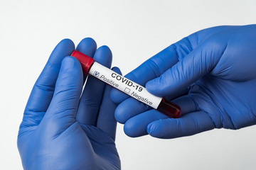 Test tube with blood for Covid-19 analyzing. Hands in medical gloves. Isolated on white background