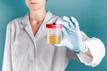 yellow urine in a plastic test jar in the hand of a blue gloved doctor