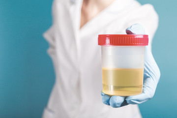 yellow urine in a plastic test jar in the hand of a blue gloved doctor