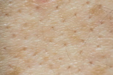 Soft focus human skin texture with black hairs for healthy textu