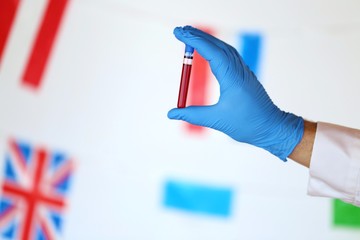 Coronavirus epidemic in the world. Coronavirus infection blood test.laboratory flask with blood and a hand in a blue medical glove on the background of the flags of the world.Viral diseases statistics
