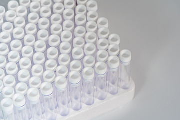 Medical vacuum venipuncture test tubes on white background