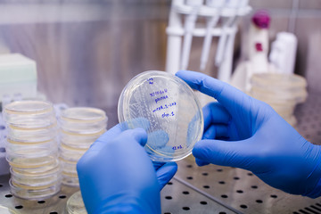 Growing bacteria to create CAR therapy - the novel method for leukemia, lymphoma therapy, and also...