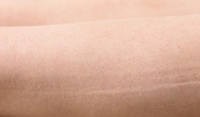 Fototapeta premium Female skin with hair on legs close-up. The concept of depilation, beauty and skin care.