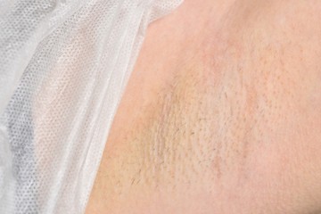 Female armpit with hair before depilation. Beauty and skin care concept.