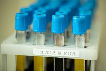 Close up holder with blood tubes of coronavirus samples, Covid-19 Negative tests