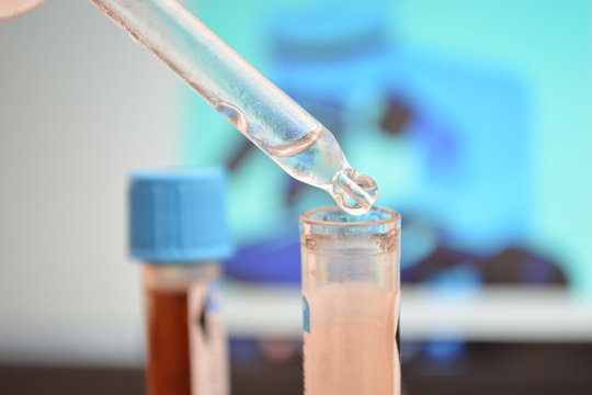 test di vaccini in provette in laboratorio
