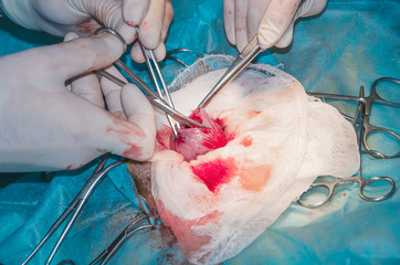 Bladder during the cut. Surgery for tumor removal