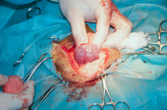 Bladder before the cut. Surgery for tumor removal.