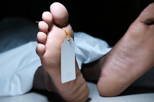 Two feet of a dead body with a tag attached to the toe