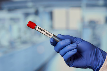 Obraz premium A hand of a lab assistant in a blue disposable medical glove holding a test tube with a vaccine against coronavirus (COVID-19) in the laboratory.
