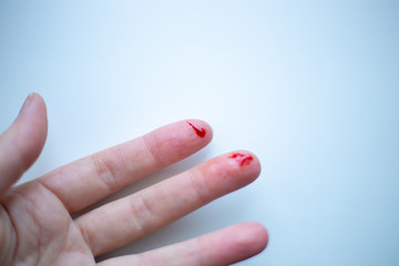 finger on his left hand is cut and bleeds with bright red blood