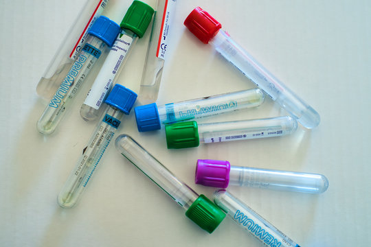 Des tubes de pr&eacute;l&egrave;vements 