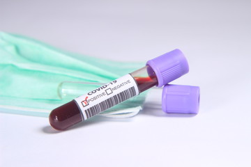 Obraz premium Close Up Photo, Simple Conceptual, Glass Blood Covid-19 Test tube, positive result, above N95 Surgical Mask